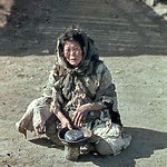 본닉 <b>안달</b>거 거머리들때매ㅋ