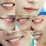[인피니트] <b>서양</b>수박 데이터많이 안드는 스밍법