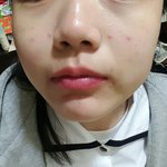 피부 <b>민감</b>한애들 어떻게 관리해...?