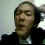 [EXO] 백현 <b>양악</b>수술전