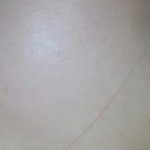 [<b>찬반</b>이라도] 피부이정도면 괜찮은거야??