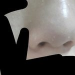 이거 <b>각질</b>이야 뭐야...ㅠㅠㅠㅠ(약혐?