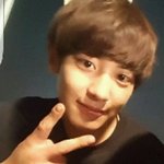 [EXO] 지금봤는데 차녈 손 <b>상태</b> <b>심각</b>하네 조카 부었다