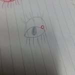 눈 위에 당겨서 보면 <b>물집</b>같은거 뭐여..