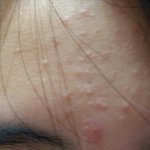 [조언부탁해] 극혐주의))나 오늘 <b>이마</b> 트러블 개쩌는데 짝남