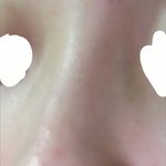 [댓글부탁해] 얘들아 나 <b>코에</b> 뭐가 났어...(죽어벌임)