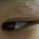 [댓글부탁해] 약혐)너희들도 <b>쌍</b><b>액</b>하면 이런거생겨?