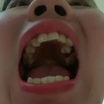 <b>치아</b> 모양이 너무 이상해