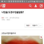[EXO] 뉴비박제