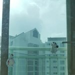 [EXO] 아 시 발 일어나보니까 손에 멍들어 있어서 뭔가 했더니