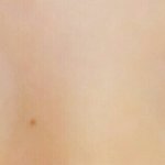 [조언부탁해] 나 겨울 방학에 쌍수하려고 하는데 후기나 뭘 해야...