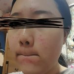 와 피부 진짜 더럽다 자살각
