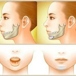 [댓글부탁해] <b>무턱</b>이나 짧턱 메이크업팁좀ㅠㅠ