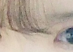 쌍수 어떤지 좀 봐줘 ㅠㅠ