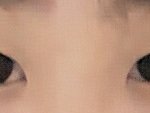 나<b>쌍수</b>할까?