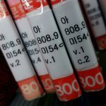 [이삐] <b>봉사</b>하고 있는데