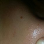 [꼭조언부탁] 코 블랙헤드 (혹시<b>라도</b> 혐오주의)