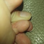 [EXO] 이거 <b>무좀</b>임??