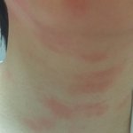 [드루와] 약혐?) 제발ㅠㅡㅜㅜ 이거 <b>알레르기</b>야??