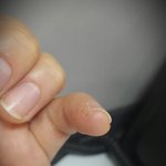 손가락 상처 <b>의문</b>(사진있음/댓글부탁)