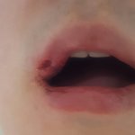 누나*닭에서 폭행당했어요. 꼭 읽어주세요