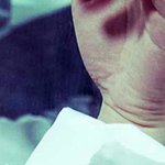 [방탄소년단] 남준이손에도<b>흉터</b>