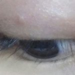 나 쌍꺼풀라인에 뭐 생겼는데 안 없어져ㅠㅠ
