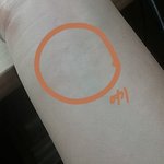 팔에동그란?<b>자국</b>있어ㅠㅜㅜㅜㅜ..