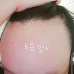 [ㅋㅋㅋㅋㅋ] 나보다 <b>이마</b> 넓은 애 있냐?ㅋㅋㄱㄱㅋㅋ