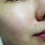 피부속 하얘지는 비결~