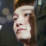 [EXO] 피부봐 ㅅㅂ ㄹㅇ <b>맥반석</b>