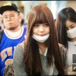 [여자친구] <b>엄지</b>야 아프지마ㅠㅠㅠㅠ