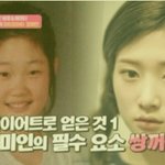 정<b>채연</b> 성형한 거 아니였어?