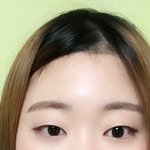 [꼭조언부탁] <b>쌍수</b> 할까 말까??