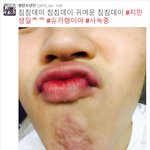 [방탄소년단] 윤기 <b>사</b>녹중..ㅠ