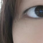 [급해] 쌍꺼풀이 사라졌어
