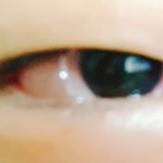 자고 일어났더니 눈 일케 됨 ㅠㅠㅠㅜ