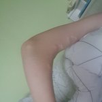 [댓글부탁해] 얘들아 내 팔 많이 이상해?