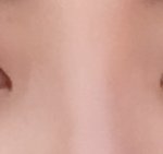<b>사진</b> <b>O</b>)쌍커풀수술하면 성괴인가요?