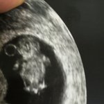 [꼭조언부탁] 남편의 전여친 상주<b>노릇</b>.. 제가 예민한걸까요?