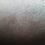 [조언부탁] 사진有) 털많은 여자.. 어떻게 생각하세요?