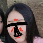 빨간 부분에 여드름 <b>원인</b>