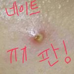[댓글부탁해] 사진혐주의)))아ㅅㅂㅅㅂㅠ내모공..ㅅㅂ