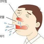 <b>비염</b> 좀 도와줘  ㅠㅠㅜ ㅠㅜ
