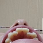 [BAP] 거부는 거부해