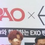 [EXO] ??????뭐야 보통 <b>다래끼</b> 나면 종대처럼