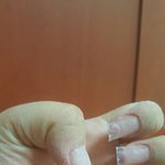 20년동안 못고치는 손톱 뜯는 습관 <b>고친</b> 1인이예요