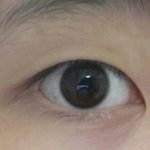 몽고<b>주름</b> 없애면 눈 커져?