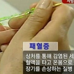 [쓰레기병원] 쓰레기병원에서 교정중 사망 할 뻔했습니다.