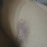 [댓글부탁해] 가정폭력당하는데 도와줘요 사진있어여ㅠㅜ